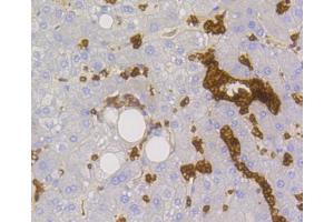 Immunohistochemistry (Paraffin-embedded Sections) (IHC (p)) image for anti-Solute Carrier Family 2 (Facilitated Glucose Transporter), Member 1 (SLC2A1) antibody (ABIN5997112)