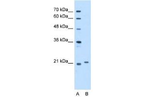 TCAP antibody used at 5 ug/ml to detect target protein. (TCAP 抗体)