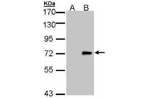 WB Image Western Blot analysis of ULK4 expression in transfected 293T cell line by ULK4 polyclonal antibody. (ULK4 抗体  (Internal Region))