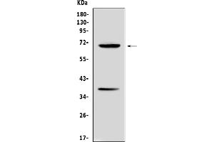 Western blot analysis of Alpha 1 Fetoprotein using anti-Alpha 1 Fetoprotein antibody (ABIN5692976). (alpha Fetoprotein 抗体  (AA 19-254))