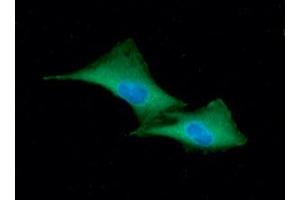 ICC/IF analysis of GSTP1 in A549 cells line, stained with DAPI (Blue) for nucleus staining and monoclonal anti-human GSTP1 antibody (1:100) with goat anti-mouse IgG-Alexa fluor 488 conjugate (Green) (GSTP1 抗体  (AA 1-210))