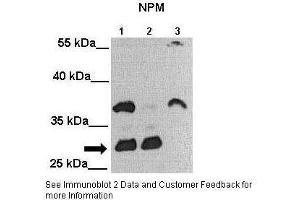 Lanes:   Lane 1: 25ug MIA PaCa-2 cell lysate Lane 2: 25ug MDA-MB-231 cell lysate Lane 3: 25ug Huh-7 cell lysate  Primary Antibody Dilution:   1:2000  Secondary Antibody:   Anti-rabbit-HRP  Secondary Antibody Dilution:   1:5000  Gene Name:   NPM1  Submitted by:   Andrei L. (NPM1 抗体  (C-Term))