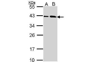 Western Blotting (WB) image for anti-SUMO1 Activating Enzyme Subunit 1 (SAE1) antibody (ABIN2856922)