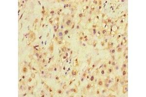 Immunohistochemistry of paraffin-embedded human placenta tissue using ABIN7168871 at dilution of 1:100 (SQSTM1 抗体  (AA 16-310))