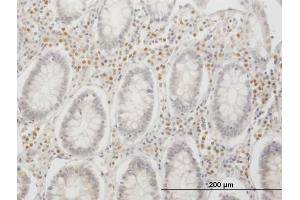 Immunoperoxidase of monoclonal antibody to IRF4 on formalin-fixed paraffin-embedded human colon. (IRF4 抗体  (AA 342-451))