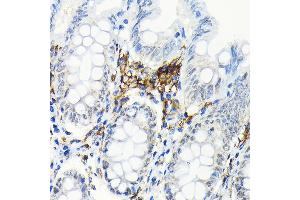 Immunohistochemistry of paraffin-embedded human colon using HLA-DRB1 Rabbit mAb (ABIN7268374) at dilution of 1:100 (40x lens). (HLA-DRB1 抗体)