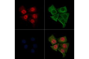 ABIN6264642 and ABIN6276374 staining Hela cells by IF/ICC. (Retinoic Acid Receptor alpha 抗体  (N-Term))