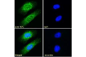 ABIN185185 Immunofluorescence analysis of paraformaldehyde fixed HeLa cells, permeabilized with 0.