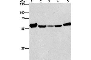 Western Blot analysis of Mouse liver tissue and Raji cell, hela, hepG2 and A549 cell using CAT Polyclonal Antibody at dilution of 1:266. (Catalase 抗体)