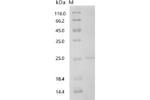 (Tris-Glycine gel) Discontinuous SDS-PAGE (reduced) with 5 % enrichment gel and 15 % separation gel.