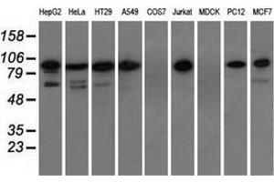 Western blot analysis of extracts (35 µg) from 9 different cell lines by using anti-TACC3 monoclonal antibody. (TACC3 抗体)