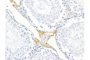 ABIN7094795 and ABIN7098846 at 1/100 staining Rat testis tissue by IHC-P. (HHIP 抗体  (C-Term))