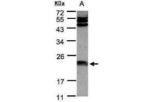 WB Image Sample(30 μg of whole cell lysate) A:Hep G2, 12% SDS PAGE antibody diluted at 1:1000 (FTL 抗体)