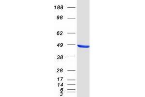 Western Blotting (WB) image for C-terminal Binding Protein 1 (CTBP1) (Transcript Variant 2) protein (Myc-DYKDDDDK Tag) (ABIN2712599)