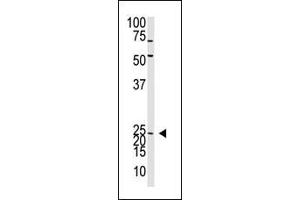 The Neurogenin2 N-term polyclonal antibody (ABIN388769 and ABIN2839073) is used in Western blot to detect Neurogenin2 in mouse liver tissue lysate. (Neurogenin 2 抗体  (C-Term))