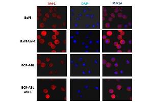 Immunofluorescence analysis in Ba/F3 cells with Ahi1 monoclonal antibody, clone 645s3( Cat # MAB8962 ) at 1 : 200 dilution. (AHI1 抗体  (C-Term))
