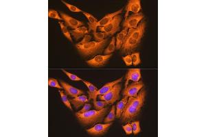 Immunofluorescence analysis of U-2 OS cells using PDI Rabbit mAb (ABIN7269615) at dilution of 1:100 (40x lens).