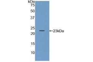 Detection of Recombinant Iga, Mouse using Polyclonal Antibody to Immunoglobulin Associated Alpha (Iga) (CD79a 抗体  (AA 30-193))