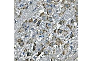 IHC analysis of CD97/Adgre5 using anti-CD97/Adgre5 antibody (ABIN7601103). (ADGRE5 (AA 287-816) 抗体)