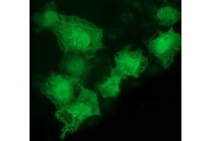 Anti-LMCD1 mouse monoclonal antibody (ABIN2454492) immunofluorescent staining of COS7 cells transiently transfected by pCMV6-ENTRY LMCD1 (RC200062). (LMCD1 抗体)