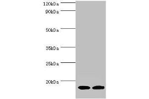 Western blot All lanes: Complexin-2 antibody at 6 μg/mL Lane 1: Rat brain tissue Lane 2: A549 whole cell lysate Secondary Goat polyclonal to rabbit IgG at 1/10000 dilution Predicted band size: 15 kDa Observed band size: 15 kDa (CPLX2 抗体  (AA 1-134))