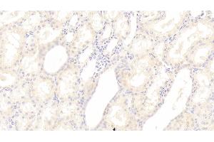 Detection of SGPL1 in Human Kidney Tissue using Polyclonal Antibody to Sphingosine 1 Phosphate Lyase 1 (SGPL1) (SGPL1 抗体  (AA 239-493))