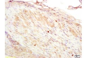 Formalin-fixed and paraffin embedded rat stomach muscle labeled with Anti-CNN2 Polyclonal Antibody, Unconjugated (ABIN1385667) at 1:200 followed by conjugation to the secondary antibody and DAB staining. (CNN2 抗体  (AA 118-150))