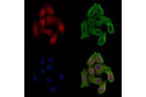 Phospho-WEE1 (Ser123) Antibody staining Hela cells(heat shock treatment) by IF/ICC. (WEE1 抗体  (pSer123))