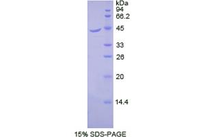 SDS-PAGE analysis of Dog beta 2-Microglobulin Protein. (beta-2 Microglobulin 蛋白)