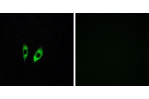 Immunofluorescence analysis of HeLa cells, using GP antibody. (GPR156 抗体)