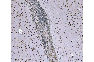IHC analysis of SNRPN using anti-SNRPN antibody (ABIN3043934).