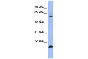 WB Suggested Anti-SFRS4 Antibody Titration: 0. (SRSF4 抗体  (Middle Region))