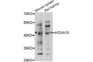 Western blot analysis of extracts of various cell lines, using HOXA10 antibody (ABIN5995981) at 1/1000 dilution. (HOXA10 抗体)