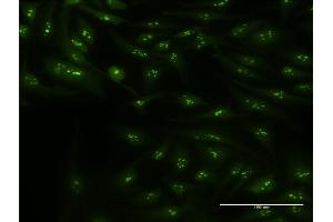 Immunofluorescence of monoclonal antibody to CIRBP on HeLa cell. (CIRBP 抗体  (AA 1-90))