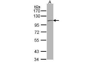 Western Blotting (WB) image for anti-Potassium Voltage-Gated Channel, KQT-Like Subfamily, Member 5 (KCNQ5) antibody (ABIN2856274)