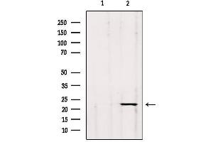 Western blot analysis of extracts from hybridoma cells, using GP1BB Antibody. (GP1BB 抗体)