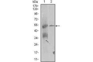 Western blot analysis using TRIP6 mouse mAb against K562 and A431 (2) cell lysate. (TRIP6 抗体  (AA 107-291))