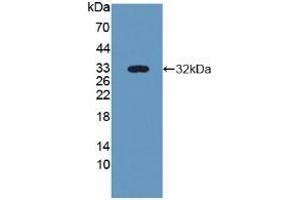 Detection of Recombinant NID2, Human using Polyclonal Antibody to Nidogen 2 (NID2) (NID2 抗体  (AA 31-289))