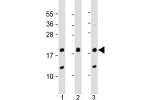 Western blot testing of human 1) A431, 2) SK-BR-3 and 3) U-2OS cell lysate with THRSP antibody at 1:2000. (THRSP 抗体  (AA 18-48))
