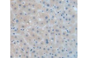 IHC-P analysis of Human Tissue, with DAB staining. (Catalase 抗体  (AA 32-167))