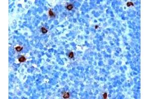 ABIN185292 (1µg/ml) staining of paraffin embedded Human Tonsil. (DOK5 抗体  (C-Term))