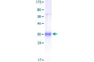 Image no. 1 for Tumor Necrosis Factor Receptor Superfamily, Member 11a, NFKB Activator (TNFRSF11A) (AA 30-212) protein (His-DYKDDDDK-Strep II Tag) (ABIN1323151)