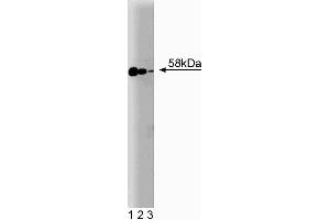 Western blot analysis of Smad2/3 on Jurkat cell lysate.