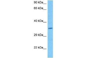 Host:  Mouse  Target Name:  DAZL  Sample Tissue:  Mouse Brain  Antibody Dilution:  1ug/ml (DAZL 抗体  (C-Term))