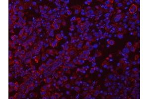 IF analysis of RAB3GAP1 using anti-RAB3GAP1 antibody (ABIN7599702).