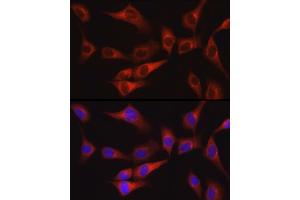 Immunofluorescence analysis of NIH/3T3 cells using FAK Rabbit pAb (ABIN6134667, ABIN6146423, ABIN6146425 and ABIN6215105) at dilution of 1:100 (40x lens). (FAK 抗体  (AA 700-800))