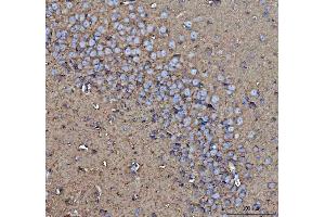 IHC analysis of CD90/Thy1 using anti-CD90/Thy1 antibody (ABIN5518877). (CD90 抗体  (AA 20-131))