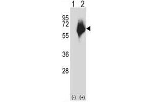 Western blot analysis of MMP2 antibody and 293 cell lysate either nontransfected (Lane 1) or transiently transfected (2) with the MMP2 gene. (MMP2 抗体  (AA 303-331))