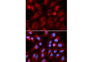 Immunofluorescence analysis of U2OS cells using PSMB2 antibody (ABIN5973193). (PSMB2 抗体)