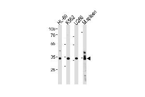 Western Blotting (WB) image for anti-Growth Factor Independent 1B Transcription Repressor (GFI1B) (AA 302-330), (C-Term) antibody (ABIN1881370)